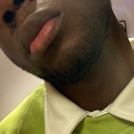Alanfotso